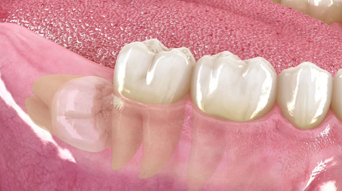 Pr&oacute;tesis y est&eacute;tica dental