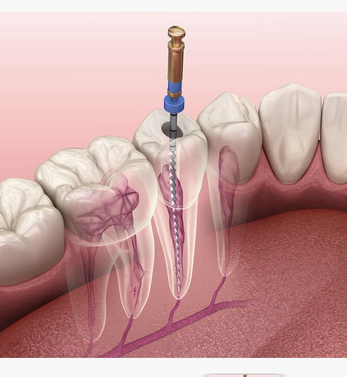 Pr&oacute;tesis y est&eacute;tica dental