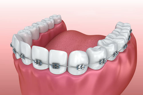 Pr&oacute;tesis y est&eacute;tica dental