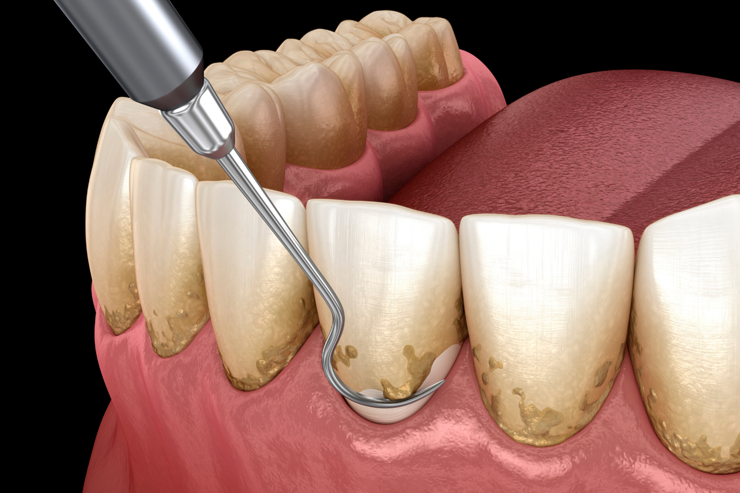 Pr&oacute;tesis y est&eacute;tica dental